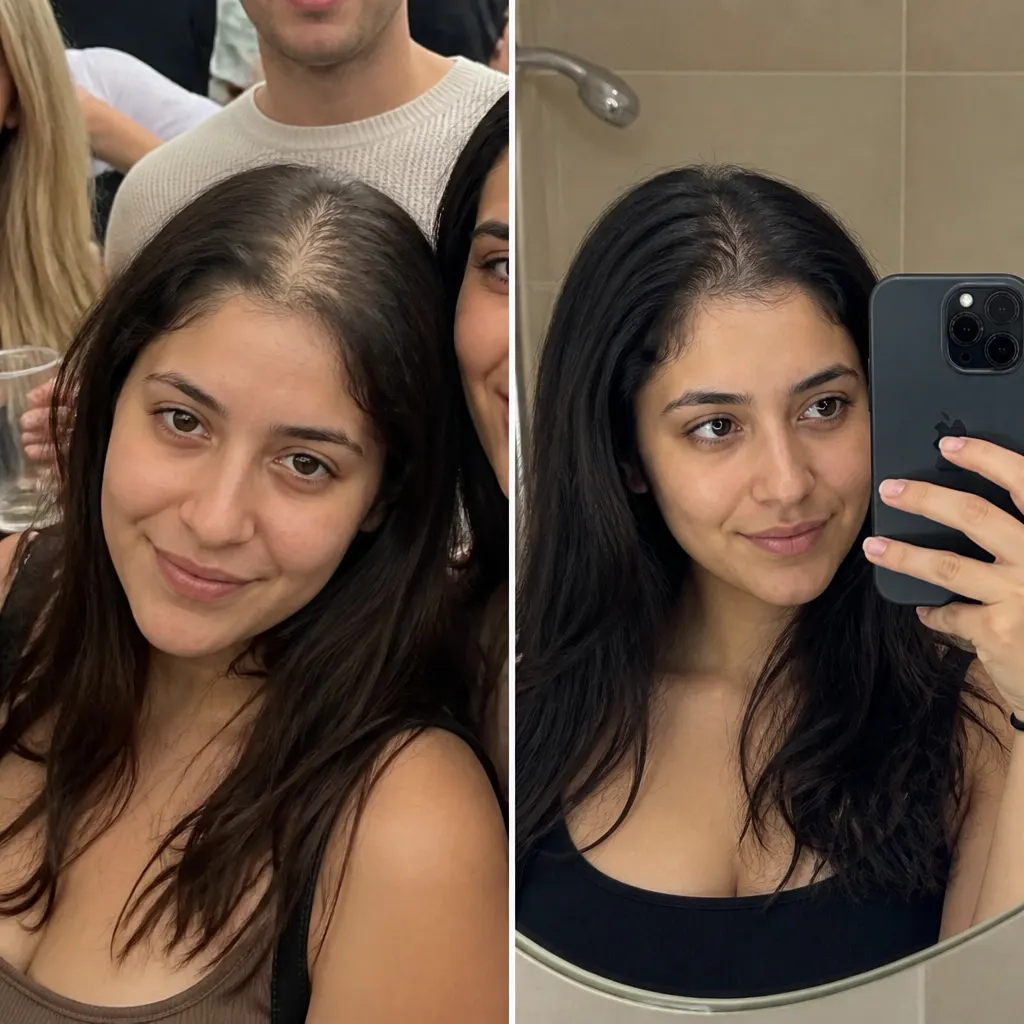 Before and after - Marcus T.